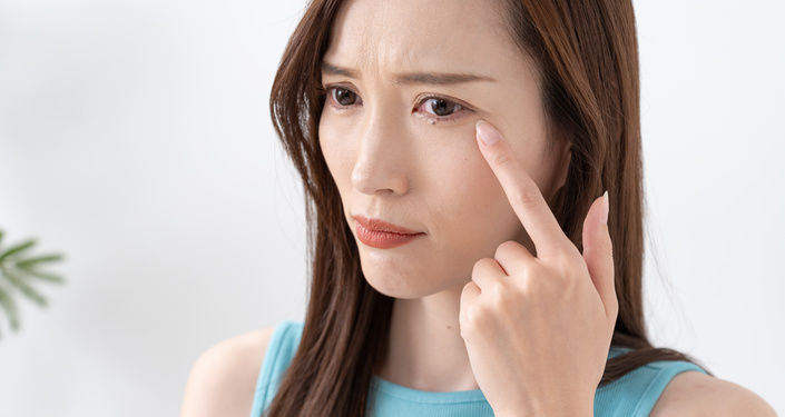 目の周りが乾燥する5つの原因