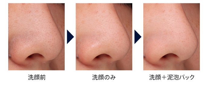 使用前後を比較した写真です