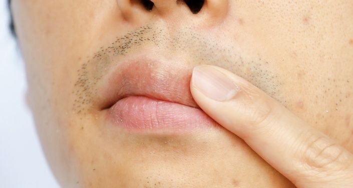 青髭が目立ってしまう理由とは？
